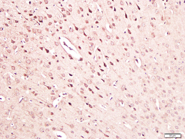 Paraformaldehyde-fixed, paraffin embedded mouse brain tissue; Antigen retrieval by boiling in sodium citrate buffer(pH6) for 15min; Block endogenous peroxidase by 3% hydrogen peroxide for 30 minutes; Blocking buffer (normal goat serum) at 37°C for 20min; Antibody incubation with Rabbit Anti-NGF Polyclonal Antibody, Unconjugated (bs-0067R) at 1:300 overnight at 4°C, followed by a conjugated secondary and DAB staining\n
