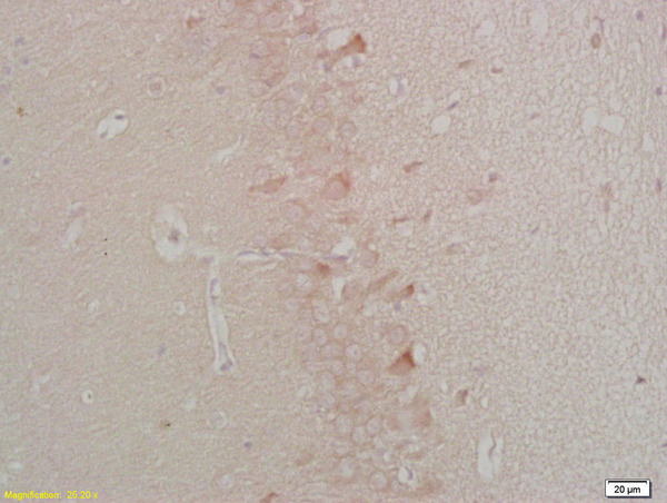 Formalin-fixed and paraffin embedded rat brain tissue labeled Anti-Chemerin/TIG2 Polyclonal Antibody, Unconjugated (bs-1501R) at 1:200, followed by conjugation to the secondary antibody and DAB staining