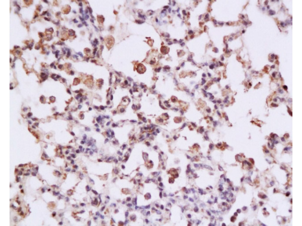 Formalin-fixed and paraffin embedded rat lung tissue labeled with Anti-STAT3 Polyclonal Antibody, Unconjugated at 1:200 followed by conjugation to the secondary antibody (bs-1141R), (SP-0023), and DAB staining
