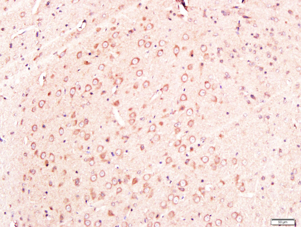 Paraformaldehyde-fixed, paraffin embedded rat brain tissue; Antigen retrieval by boiling in sodium citrate buffer(pH6) for 15min; Block endogenous peroxidase by 3% hydrogen peroxide for 30 minutes; Blocking buffer (normal goat serum) at 37°C for 20min; Antibody incubation with Rabbit Anti-Neuroglycan Polyclonal Antibody, Unconjugated (bs-11323R) at 1:300 overnight at 4°C, followed by a conjugated secondary and DAB staining\n