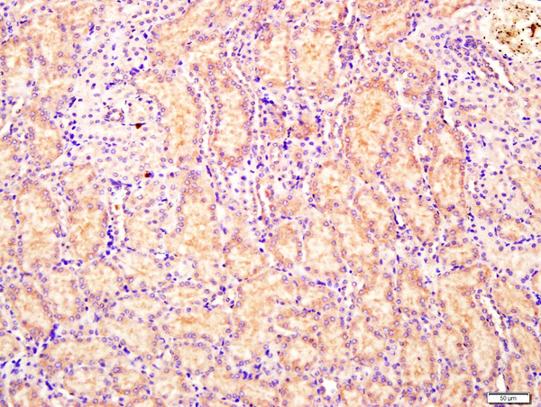 Paraformaldehyde-fixed, paraffin embedded Mouse kidney; Antigen retrieval by boiling in sodium citrate buffer (pH6.0) for 15min; Block endogenous peroxidase by 3% hydrogen peroxide for 20 minutes; Blocking buffer (normal goat serum) at 37°C for 30min; Antibody incubation with CEMIP Polyclonal Antibody, Unconjugated (bs-8059R) at 1:400 overnight at 4°C, followed by a conjugated secondary antibody for 20 minutes and DAB staining.