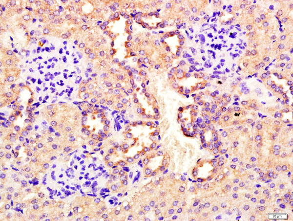 Paraformaldehyde-fixed, paraffin embedded Mouse kidney; Antigen retrieval by boiling in sodium citrate buffer (pH6.0) for 15min; Block endogenous peroxidase by 3% hydrogen peroxide for 20 minutes; Blocking buffer (normal goat serum) at 37°C for 30min; Antibody incubation with CEMIP Polyclonal Antibody, Unconjugated (bs-8059R) at 1:400 overnight at 4°C, followed by a conjugated secondary antibody for 20 minutes and DAB staining. Paraformaldehyde-fixed, paraffin embedded Mouse kidney; Antigen retrieval by boiling in sodium citrate buffer (pH6.0) for 15min; Block endogenous peroxidase by 3% hydrogen peroxide for 20 minutes; Blocking buffer (normal goat serum) at 37°C for 30min; Antibody incubation with CEMIP Polyclonal Antibody, Unconjugated (bs-8059R) at 1:400 overnight at 4°C, followed by a conjugated secondary antibody for 20 minutes and DAB staining.