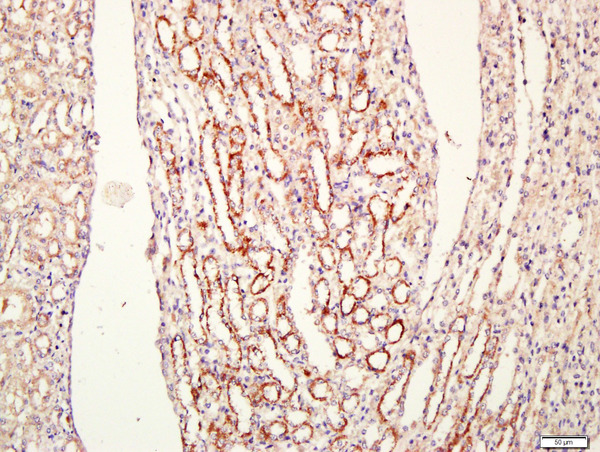 Paraformaldehyde-fixed, paraffin embedded (Rat kidney); Antigen retrieval by boiling in sodium citrate buffer (pH6.0) for 15min; Block endogenous peroxidase by 3% hydrogen peroxide for 20 minutes; Blocking buffer (normal goat serum) at 37°C for 30min; Antibody incubation with CEMIP Polyclonal Antibody, Unconjugated (bs-8059R) at 1:400 overnight at 4°C, followed by a conjugated secondary antibody for 20 minutes and DAB staining. Paraformaldehyde-fixed, paraffin embedded (Rat kidney); Antigen retrieval by boiling in sodium citrate buffer (pH6.0) for 15min; Block endogenous peroxidase by 3% hydrogen peroxide for 20 minutes; Blocking buffer (normal goat serum) at 37°C for 30min; Antibody incubation with CEMIP Polyclonal Antibody, Unconjugated (bs-8059R) at 1:400 overnight at 4°C, followed by a conjugated secondary antibody for 20 minutes and DAB staining.
