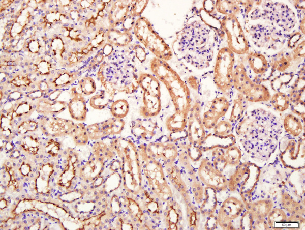 Paraformaldehyde-fixed, paraffin embedded rat kidney tissue; Antigen retrieval by boiling in sodium citrate buffer(pH6) for 15min; Block endogenous peroxidase by 3% hydrogen peroxide for 30 minutes; Blocking buffer (normal goat serum) at 37°C for 20min; Antibody incubation with Rabbit Anti-SIRT4 Polyclonal Antibody, Unconjugated (bs-7537R) at 1:400 overnight at 4°C, followed by a conjugated secondary and DAB staining\n