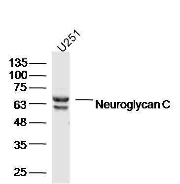 Human U251 cells probed with Neuroglycan C Polyclonal Antibody, unconjugated (bs-11323R) at 1:300 overnight at 4°C followed by a conjugated secondary antibody at 1:10000 for 90 minutes at 37°C.\n