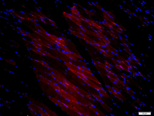 Paraformaldehyde-fixed, paraffin embedded mouse skeletal muscle; Antigen retrieval by boiling in sodium citrate buffer (pH6) for 15min; Block endogenous peroxidase by 3% hydrogen peroxide for 20 minutes; Blocking buffer (normal goat serum) at 37°C for 30min; Antibody incubation with CDCP1 Polyclonal Antibody, Unconjugated (bs-5880R) at 1:200 overnight at 4°C, followed by a conjugated secondary at [1:500] for 90 minutes and DAPI staining of the nuclei.