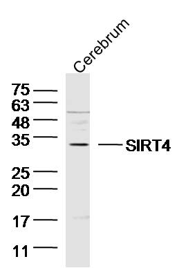 Mouse cerebrum lysates probed with SIRT4 Polyclonal Antibody, unconjugated (bs-7537R) at 1:300 overnight at 4°C followed by a conjugated secondary antibody at 1:10000 for 90 minutes at 37°C.\n