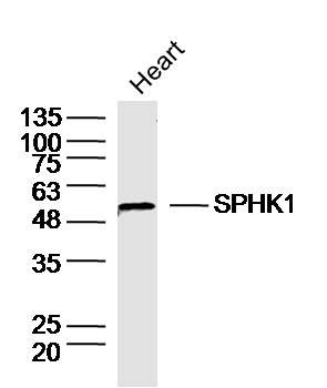 Mouse heart lysates probed with SPHK1 Polyclonal Antibody, unconjugated (bs-2652R) at 1:30 overnight at 4°C followed by a conjugated secondary antibody at 1:10000 for 90 minutes at 37°C.\n