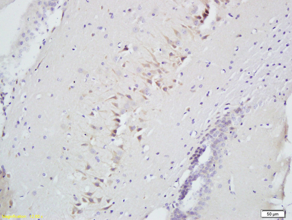 Formalin-fixed and paraffin embedded rat brain labeled with Anti-CD160\/BY55 Polyclonal Antibody (bs-2526R), Unconjugated at 1:200 followed by conjugation to the secondary antibody