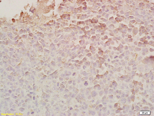 Formalin-fixed and paraffin embedded rat brain tissue labeled Anti-Chemerin/TIG2 Polyclonal Antibody, Unconjugated (bs-1501R) at 1:200, followed by conjugation to the secondary antibody and DAB staining
