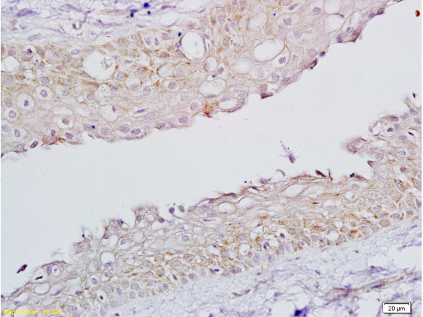 Formalin-fixed and paraffin embedded rat ovary tissue labeled with  Rabbit Anti-FSH receptor Polyclonal Antibody, Unconjugated (bs-0895R) 1:200 followed by conjugation to the secondary antibody and DAB staining.