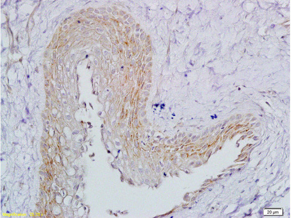 Formalin-fixed and paraffin embedded rat ovary tissue labeled with (bs-0895R) Rabbit Anti-FSH receptor Polyclonal Antibody, Unconjugated1:200 followed by conjugation to the secondary antibody and DAB staining.