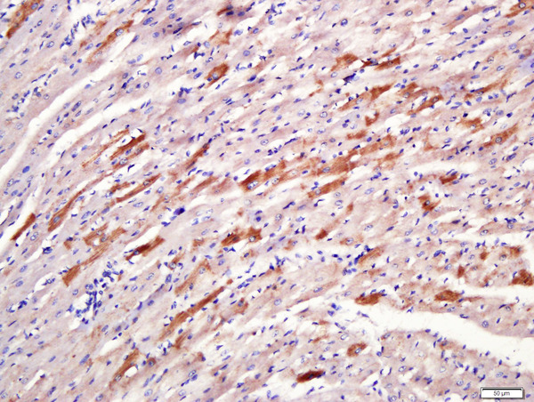 Paraformaldehyde-fixed, paraffin embedded rat heart tissue; Antigen retrieval by boiling in sodium citrate buffer(pH6) for 15min; Block endogenous peroxidase by 3% hydrogen peroxide for 30 minutes; Blocking buffer (normal goat serum) at 37°C for 20min; Antibody incubation with Rabbit Anti-SLC11A2 Polyclonal Antibody, Unconjugated (bs-3577R) at 1:400 overnight at 4°C, followed by a conjugated secondary and DAB staining