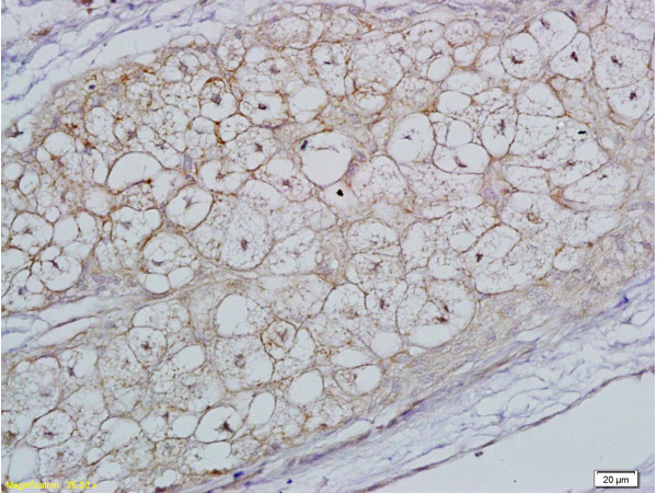 Formalin-fixed and paraffin embedded rat ovary tissue labeled with  Rabbit Anti-FSH receptor Polyclonal Antibody, Unconjugated (bs-0895R) 1:200 followed by conjugation to the secondary antibody and DAB staining.