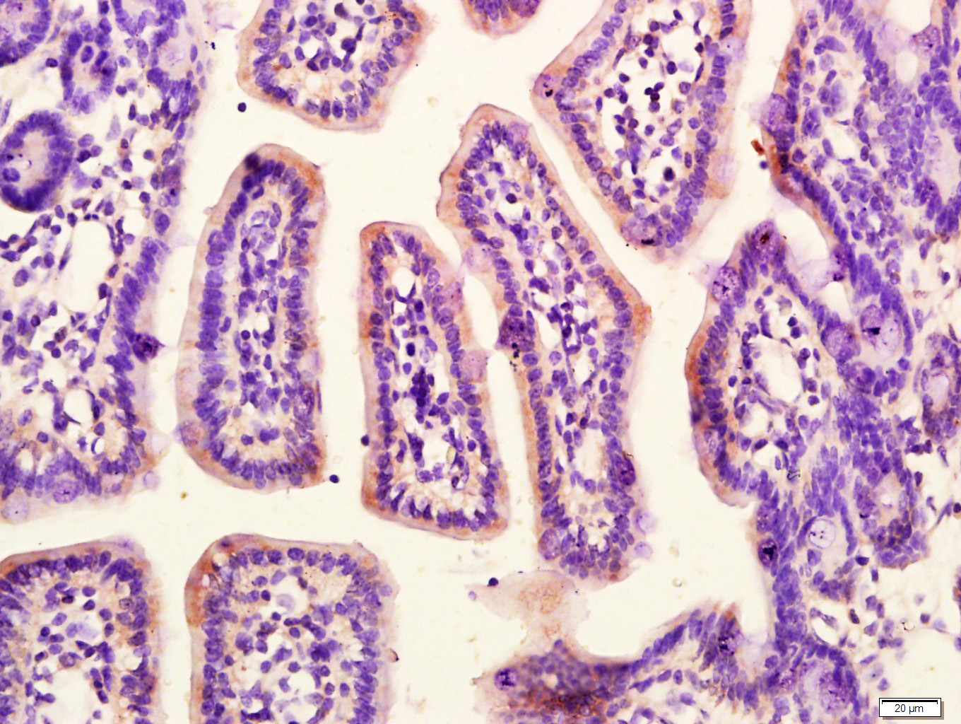 Paraformaldehyde-fixed, paraffin embedded Mouse small intestine; Antigen retrieval by boiling in sodium citrate buffer (pH6.0) for 15min; Block endogenous peroxidase by 3% hydrogen peroxide for 20 minutes; Blocking buffer (normal goat serum) at 37°C for 30min; Antibody incubation with G protein alpha S; GNAS Polyclonal Antibody, Unconjugated (bs-3939R) at 1:400 overnight at 4°C, followed by a conjugated secondary antibody for 20 minutes and DAB staining.