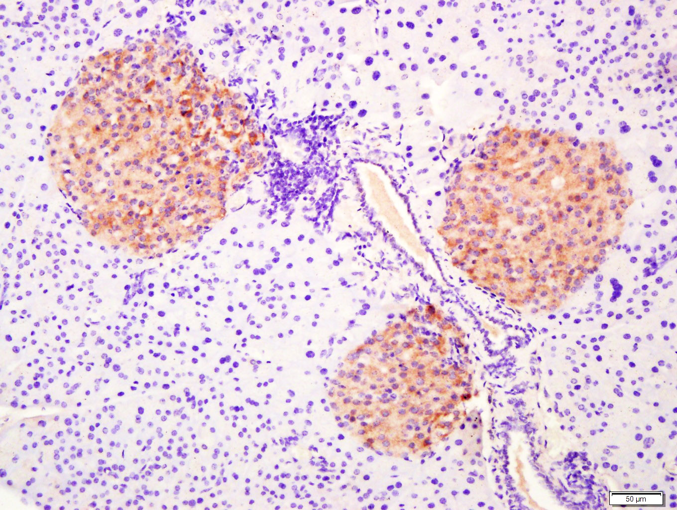 Paraformaldehyde-fixed, paraffin embedded Mouse pancreas; Antigen retrieval by boiling in sodium citrate buffer (pH6.0) for 15min; Block endogenous peroxidase by 3% hydrogen peroxide for 20 minutes; Blocking buffer (normal goat serum) at 37°C for 30min; Antibody incubation with G protein alpha S Polyclonal Antibody, Unconjugated (bs-3939R) at 1:400 overnight at 4°C, followed by a conjugated secondary antibody for 20 minutes and DAB staining.