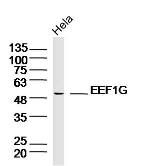 Lane 1: HeLa lysates probed with EEF1G Polyclonal Antibody, Unconjugated (bs-13056R) at 1:300 overnight at 4˚C. Followed by a conjugated secondary antibody at 1:5000 for 90 min at 37˚C.
