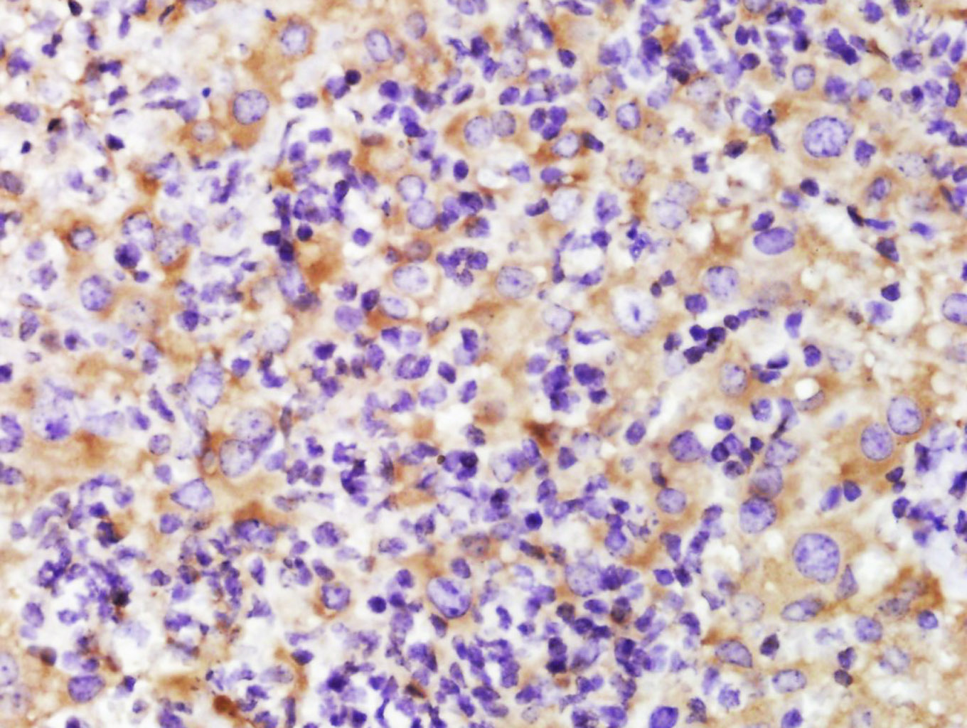 Paraformaldehyde-fixed, paraffin embedded Mouse liver tissue; Antigen retrieval by boiling in sodium citrate buffer(pH6) for 15min; Block endogenous peroxidase by 3% hydrogen peroxide for 30 minutes; Blocking buffer (normal goat serum) at 37°C for 20min; Antibody incubation with alpha Tubulin (4G1) monoclonal Antibody, Unconjugated (bsm-50179M) at 1:500 overnight at 4°C, followed by a conjugated secondary and DAB staining