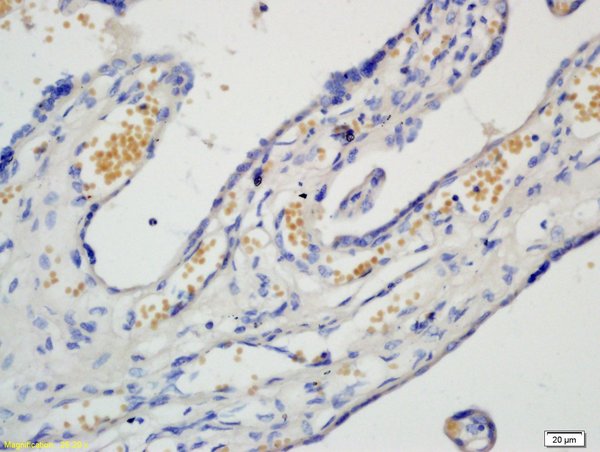 Formalin-fixed and paraffin embedded human placenta tissue labeled with Rabbit Anti-PAF Polyclonal Antibody, Unconjugated (bs-1119R) 1:200 followed by conjugation to the secondary antibody and DAB staining Formalin-fixed and paraffin embedded human placenta tissue labeled with Rabbit Anti-PAF Polyclonal Antibody, Unconjugated (bs-1119R) 1:200 followed by conjugation to the secondary antibody and DAB staining