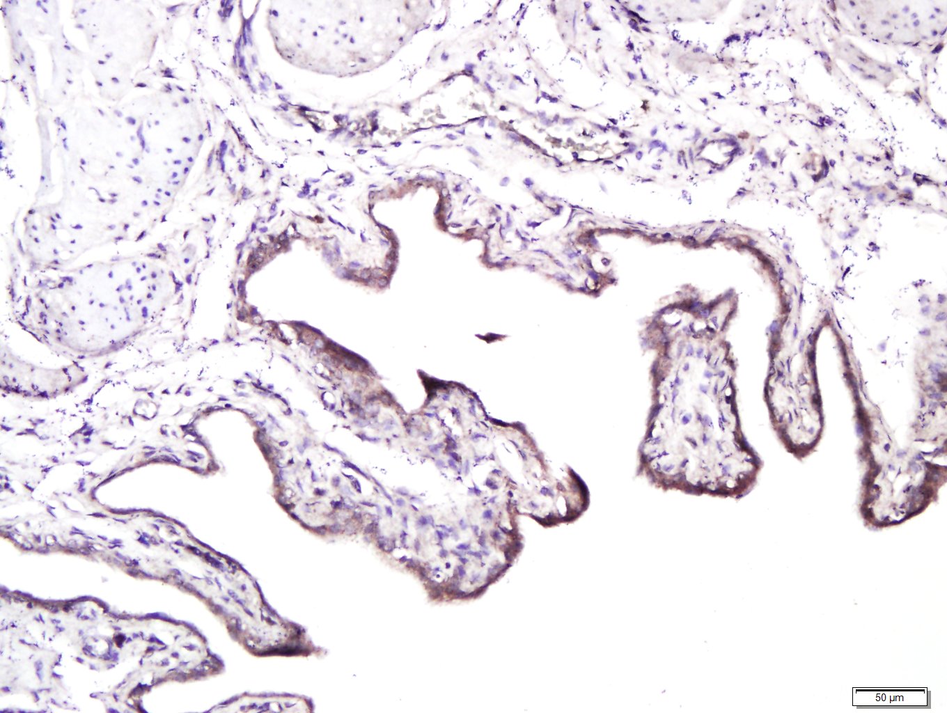 Paraformaldehyde-fixed, paraffin embedded rat bladder; Antigen retrieval by boiling in sodium citrate buffer (pH6) for 15min; Block endogenous peroxidase by 3% hydrogen peroxide for 30 minutes; Blocking buffer (normal goat serum) at 37°C for 20min; Antibody incubation with _x000D_ Syndecan 1 Polyclonal Antibody, Unconjugated (bs-1309R) at 1:400 overnight at 4°C, followed by a conjugated secondary and for 20 minutes and DAB staining.