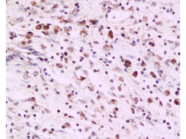 Formalin-fixed and paraffin embedded rat colon tissue labeled with Anti-PAF Polyclonal Antibody, Unconjugated(bs-1119R) at 1:200 followed by conjugation to the secondary antibody and DAB staining