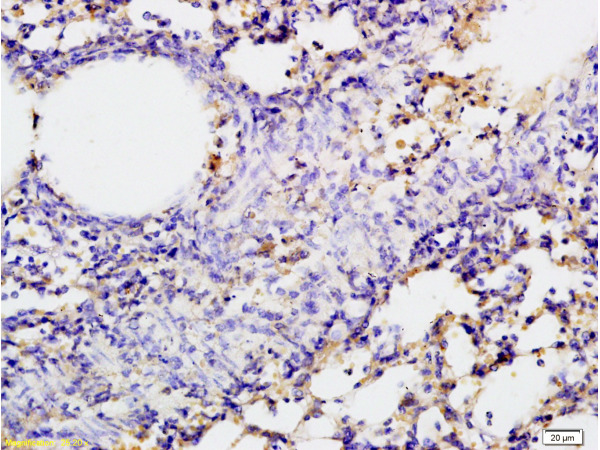 Formalin-fixed and paraffin embedded rat lung tissue labeled with Rabbit Anti-SGLT1 Polyclonal Antibody, Unconjugated (bs-1128R)1:200 followed by conjugation to the secondary antibody and DAB staining