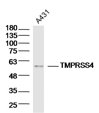 Lane 1: A431 lysates probed with TMPRSS4 Polyclonal Antibody, Unconjugated (bs-6286R) at 1:300 overnight at 4˚C. Followed by a conjugated secondary antibody at 1:10000 for 60 min at 37˚C.