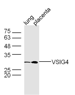 Mouse lung and placenta lysates probed with VSIG4 Polyclonal Antibody, unconjugated (bs-0479R) at 1:300 overnight at 4\u00b0C followed by a conjugated secondary antibody at 1:10000 for 90 minutes at 37\u00b0C.