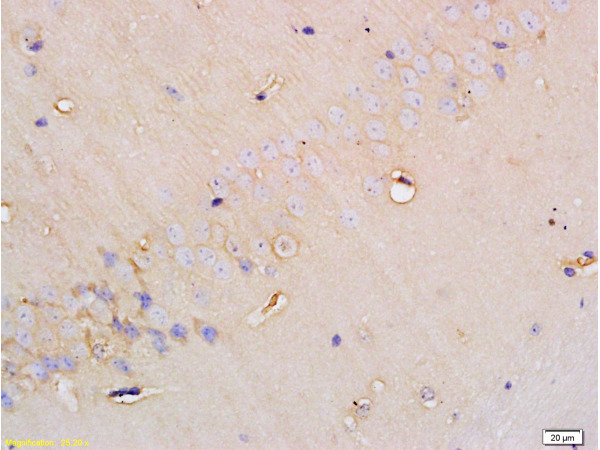 Formalin-fixed and paraffin embedded rat brain tissue labeled with Anti-SGLT1 Polyclonal Antibody, Unconjugated(bs-1128R) at 1:200 followed by conjugation to the secondary antibody and DAB staining