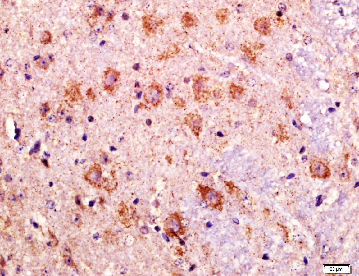 Paraformaldehyde-fixed, paraffin embedded mouse brain tissue; Antigen retrieval by boiling in sodium citrate buffer(pH6) for 15min; Block endogenous peroxidase by 3% hydrogen peroxide for 30 minutes; Blocking buffer (normal goat serum) at 37°C for 20min; Antibody incubation with Rabbit Anti-LAGY Polyclonal Antibody, Unconjugated (bs-9462R) at 1:400 overnight at 4°C, followed by a conjugated secondary and DAB staining Paraformaldehyde-fixed, paraffin embedded mouse brain tissue; Antigen retrieval by boiling in sodium citrate buffer(pH6) for 15min; Block endogenous peroxidase by 3% hydrogen peroxide for 30 minutes; Blocking buffer (normal goat serum) at 37°C for 20min; Antibody incubation with Rabbit Anti-LAGY Polyclonal Antibody, Unconjugated (bs-9462R) at 1:400 overnight at 4°C, followed by a conjugated secondary and DAB staining