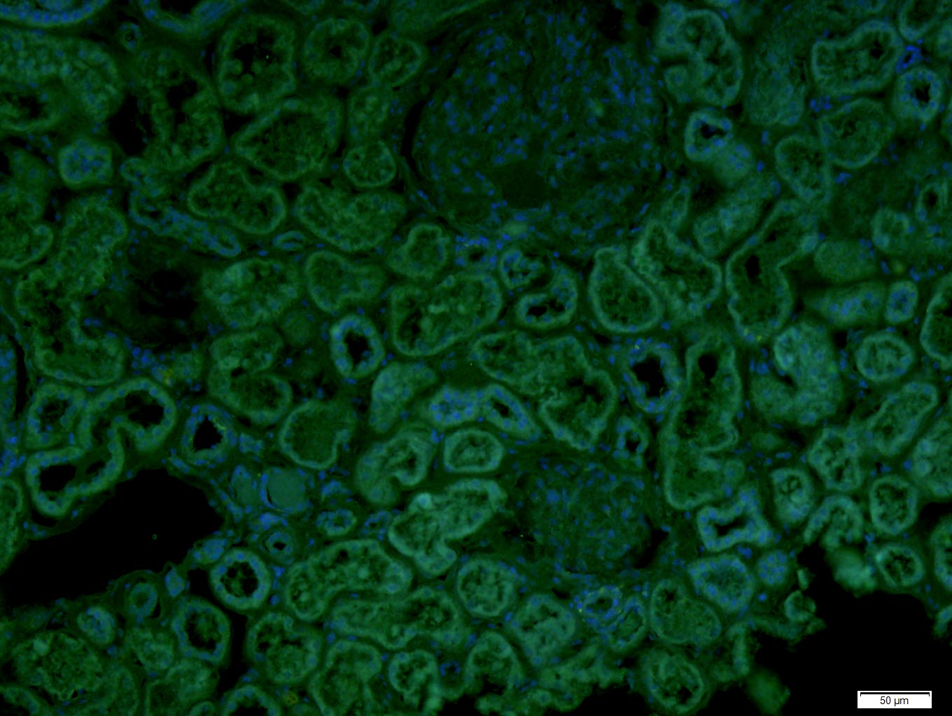 Paraformaldehyde-fixed, paraffin embedded Human kidney; Antigen retrieval by boiling in sodium citrate buffer (pH6.0) for 15min; Block endogenous peroxidase by 3% hydrogen peroxide for 20 minutes; Blocking buffer (normal goat serum) at 37°C for 30min; Antibody incubation with CECR1 Polyclonal Antibody, Unconjugated (bs-9005R) at 1:400 overnight at 4°C, followed by a secondary antibody for 90 minutes and DAPI for nuclei staining.