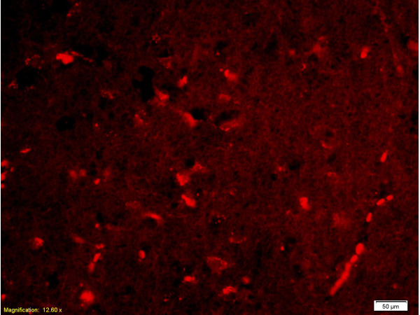 Formalin-fixed and paraffin-embedded human brain labeled with Rabbit Anti-NGAL Polyclonal Antibody, Unconjugated(bs-1373R) 1:200 followed by conjugation to the PE secondary antibody and DAPI staining