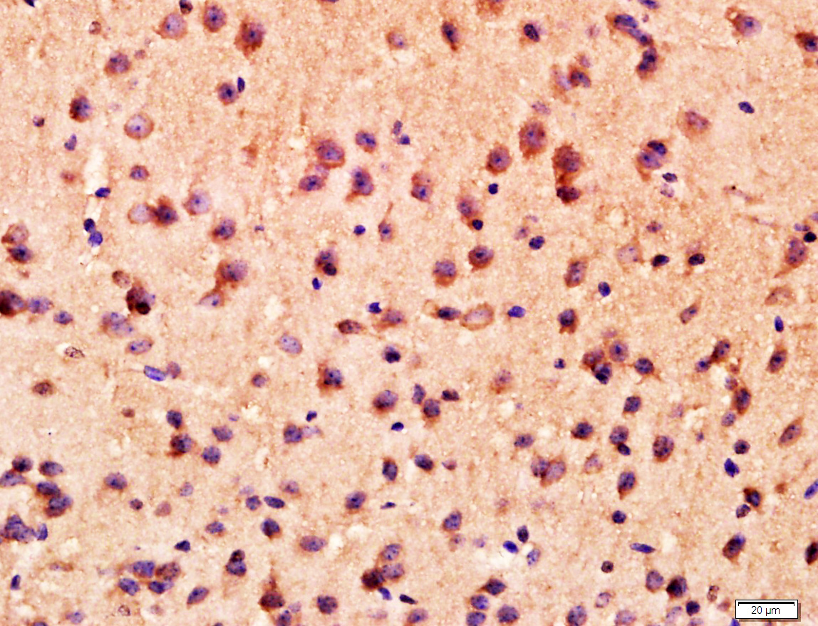 Mouse brain lysates probed with ANKK1 Polyclonal Antibody, unconjugated (bs-12475R) at 1:400 overnight at 4°C followed by a conjugated secondary antibody for 20 minutes at 37°C.
