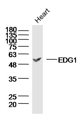 Rat heart lysates probed with S1P1 Polyclonal Antibody, unconjugated (bs-7112R) at 1:300 overnight at 4°C followed by a conjugated secondary antibody at 1:10000 for 90 minutes at 37°C.