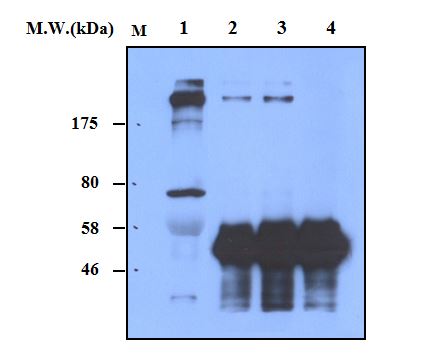 Immunoprecipitation of FibronectinÊfrom human serum using Fibronectin (16E5) Monoclonal Antibody (bsm-50208M). 
Lane 1 : Human Serum (0.5uL); Lane 2 : Precipitated from 1ul of Human Serum using 2ug of antibody; Lane 3 : Precipitated from 1ul of Human Serum using 5ug of antibody; Lane 4 : Precipitated from PBS using 5ug of antibody. WB analysis was performed using bsm-50208M at 1.0ug/mL (1:1000) and incubated at 4_ overnight, followed by secondary antibody incubation for 60min at room temperature.