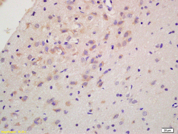 Formalin-fixed and paraffin embedded rat brain labeled with Anti-RGS2 Polyclonal Antibody, Unconjugated (bs-0492R) at 1:200 followed by conjugation to the secondary antibody and DAB staining.