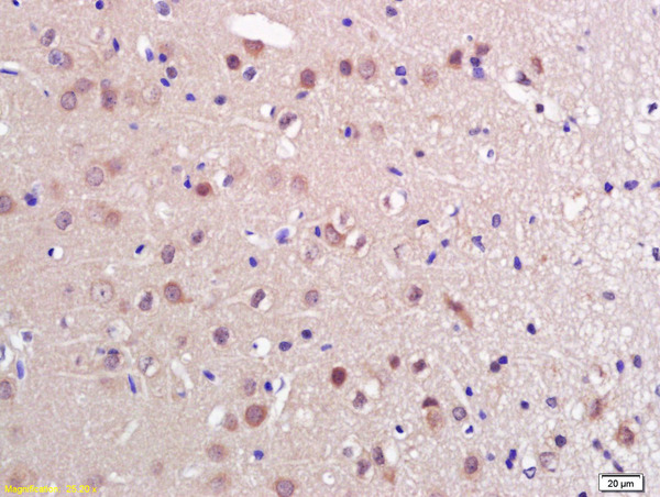 Formalin-fixed and paraffin embedded rat brain labeled with Anti-PRL Polyclonal Antibody, Unconjugated (bs-0508R) at 1:200 followed by conjugation to the secondary antibody and DAB staining.