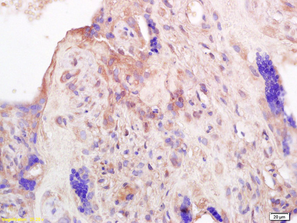 Formalin-fixed and paraffin embedded human placenta labeled with Anti-PRL Polyclonal Antibody, Unconjugated (bs-0508R) at 1:200 followed by conjugation to the secondary antibody and DAB staining.