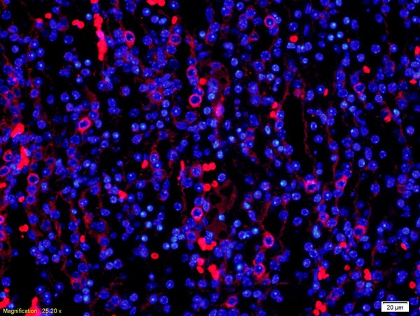 Formalin-fixed and paraffin-embedded mouse kidney labeled with Anti-PDCD4 Polyclonal Antibody, Unconjugated(bs-1608R) 1:200, overnight at 4°C, The secondary antibody was Goat Anti-Rabbit IgG, Cy3 conjugated(bs-0295G-Cy3)used at 1:200 dilution for 40 minutes at 37°C.