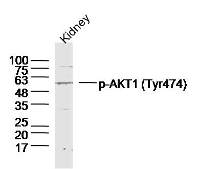 Mouse kidney lysates probed with AKT1/2/3 (Tyr474) Polyclonal Antibody, unconjugated (bs-10133R) at 1:300 overnight at 4°C followed by a conjugated secondary antibody at 1:10000 for 90 minutes at 37°C._x000D_
