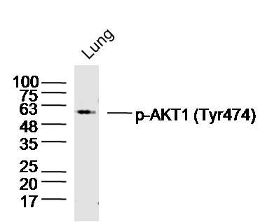 Mouse lung lysates probed with AKT1/2/3 (Tyr474) Polyclonal Antibody, unconjugated (bs-10133R) at 1:300 overnight at 4°C followed by a conjugated secondary antibody at 1:10000 for 90 minutes at 37°C._x000D_