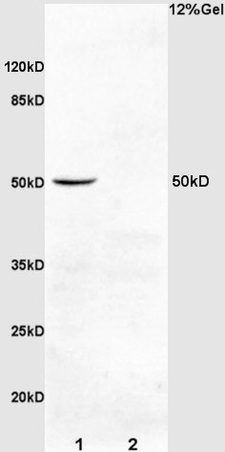 L1 rat kidney lysates L2 mouse colon carcinoma lysates probed with Anti IL-2R gamma/CD132 Polyclonal Antibody, Unconjugated (bs-1608R) at 1:200 overnight at 4˚C. Followed by conjugation to secondary antibody (bs-0295G-HRP) at 1:3000 for 90 min at 37˚C. Predicted band 50kD. Observed band size:50kD.\n