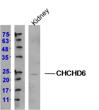 Lane 1: (mouse)Kidney lysates; probed with CHCHD6 Polyclonal Antibody, Unconjugated (Catalog #bs-8167R) at 1:300 overnight at 4˚C. Followed by a conjugated secondary antibody for 60 min at 37˚C.