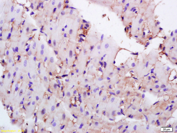 Formalin-fixed and paraffin embedded rat heart tissue labeled with Anti-CD36\/PAS-4 Polyclonal Antibody, Unconjugated (bs-1100R) at 1:200 followed by conjugation to the secondary antibody and DAB staining.