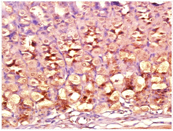 Paraformaldehyde-fixed, paraffin embedded Mouse stomach; Antigen retrieval by boiling in sodium citrate buffer (pH6.0) for 15min; Block endogenous peroxidase by 3% hydrogen peroxide for 20 minutes; Blocking buffer (normal goat serum) at 37°C for 30min; Antibody incubation with DIO2 Polyclonal Antibody, Unconjugated (bs-3673R) at 1:400 overnight at 4°C, followed by a conjugated secondary antibody for 20 minutes and DAB staining.