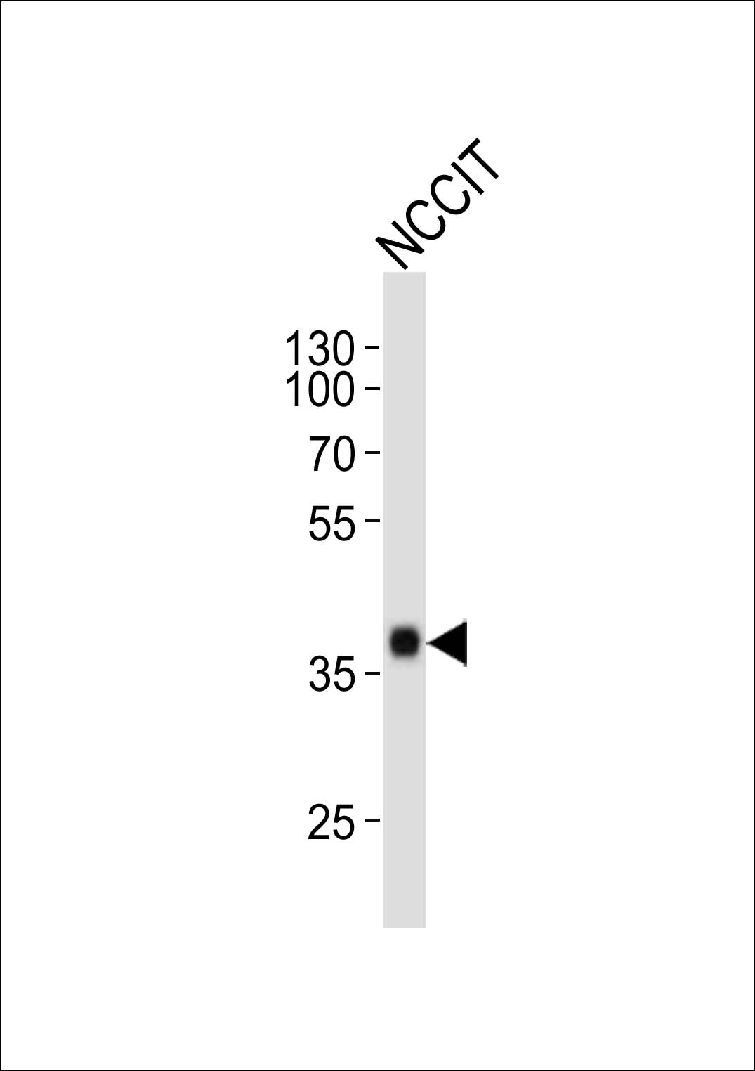 NCCIT cell lysate probed with bsm-51142M SOX2 (7C4) Monoclonal Antibody at 1:1000 dilution and 4℃ overnight incubation, followed by secondary antibody incubation for 60min at room temperature.