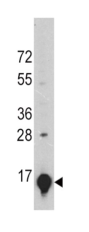 A375 cell lysates probed with GLT (24CT661.4.3) Monoclonal Antibody, unconjugated (bsm-51017M) at 1:1000 overnight at 4°C followed by a conjugated secondary antibody for 60 minutes at Room Temperature.