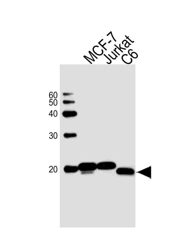 Sample Tissue/Cells lysates probed with antibodyname Monoclonal Antibody, unconjugated (bsm-51413M) at 1:1000 overnight at 4°C followed by a conjugated secondary antibody for 60 minutes at Room Temperature.