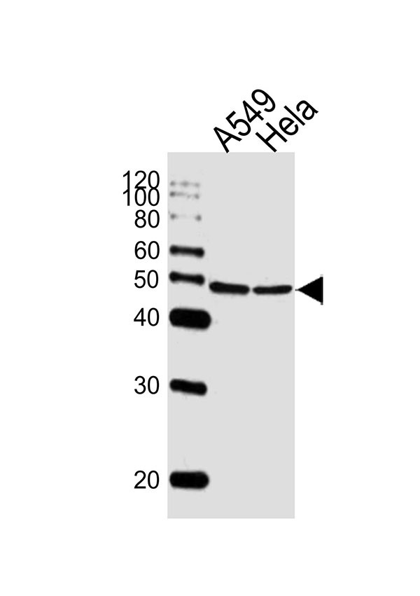 Lane 1: A549 lysates; Lane 2:HeLa lysates; probed with CBX8 (12C7) Monoclonal Antibody, unconjugated (bsm-51407M) at 1:1000 overnight at 4°C followed by a conjugated secondary antibody for 60 minutes at 37°C.
