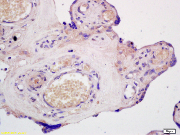 Formalin-fixed and paraffin embedded human placenta labeled with Anti-ABCG1 Polyclonal Antibody, Unconjugated (bs-1231R) at 1:200 followed by conjugation to the secondary antibody and DAB staining.